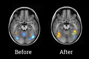 Brain Scans Kids Reading